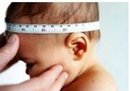 HIDROCEFALIA EXTERNA IDIOPATICA.