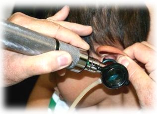 DIAGNOSTICO Y MANEJO DE LA OTITIS MEDIA AGUDA. 