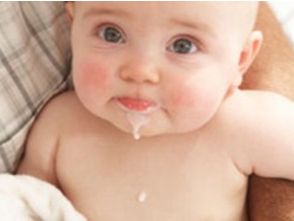 REFLUJO GASTROESOFAGICO 