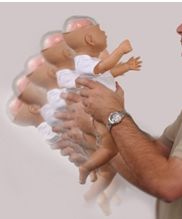 EL SINDROME DEL BEBE “SACUDIDO” (SHAKEN BABY SYNDROME) 