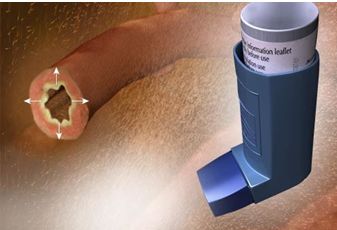 SALBUTAMOL EN PEDIATRÍA